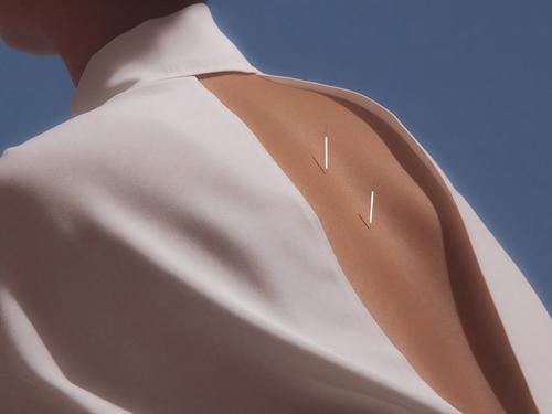 밝은 푸른 하늘을 배경으로 두 개의 미세한 침술 바늘이 꽂힌 사람의 등 윗부분